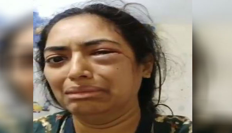 खून के आंसू रोती हुई महिला ने वीडियो जारी कर कहा - अम्मी-अब्बा मेरी मदद करो... 