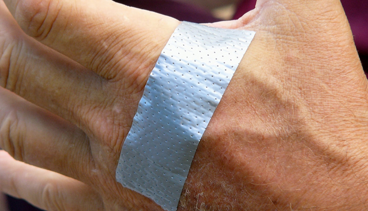 warts,warts treatment,home remedies to treat warts,warts problem,warts problem solution,Health,Health tips