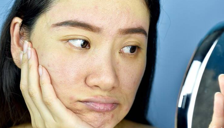 vitamin e capsules benefits for skin,vitamin e for healthy skin,benefits of vitamin e oil for skin,vitamin e capsules for skin care,vitamin e capsules uses for skin,vitamin e skin benefits,vitamin e capsules beauty benefits,vitamin e capsules for glowing skin,vitamin e capsules for skin nourishment,vitamin e capsules for skin repair,vitamin e capsules for youthful skin,how to use vitamin e capsules for skin health