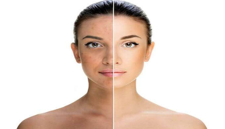 सांवली त्वचा को फिर से बनाए खूबसूरत, अपनाए ये 4 ख़ास उपाय 