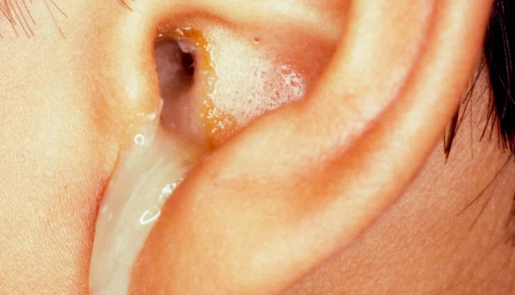 ear cancer symptoms,signs of ear cancer,dont ignore these ear cancer symptoms,warning signs of ear cancer,symptoms indicating ear cancer,early signs of ear cancer,recognizing ear cancer symptoms,possible indications of ear cancer,understanding ear cancer symptoms,ear cancer red flags,noteworthy symptoms of ear cancer,investigate these ear cancer symptoms,ear cancer symptom checklist,unusual symptoms that could be ear cancer,ear cancer symptom awareness