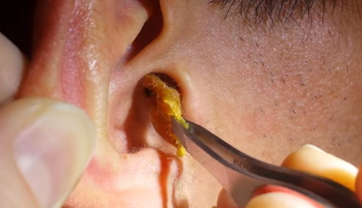कान में जमा वैक्स बन सकता हैं बहरेपन का कारण, इन उपायों से करें इनकी सफाई 
