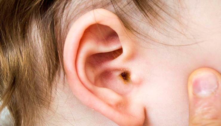 ear bud side effects,risks of using ear buds,negative effects of ear bud usage,harmful impacts of using ear buds,ear bud-related health issues,dangers of prolonged ear bud use,ear bud usage and its side effects,health risks associated with ear bud usage,ear bud complications and drawbacks,ear bud hazards and adverse effects