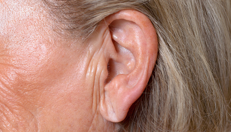 clogged arteries,symptoms of clogged arteries,arteries,angina,chest pain,shortness of breath,erectile dysfunction,male pattern baldness,earlobe crease,Health,Health tips