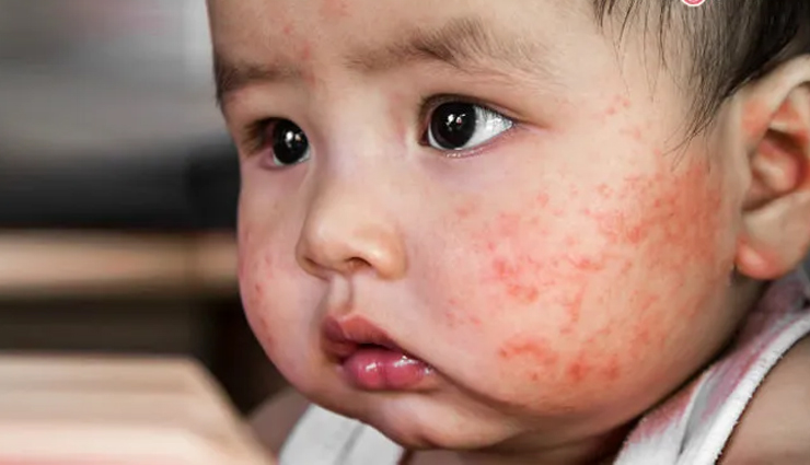 benefits of giving probiotics to infants,probiotics benefits,healthy living,Health tips