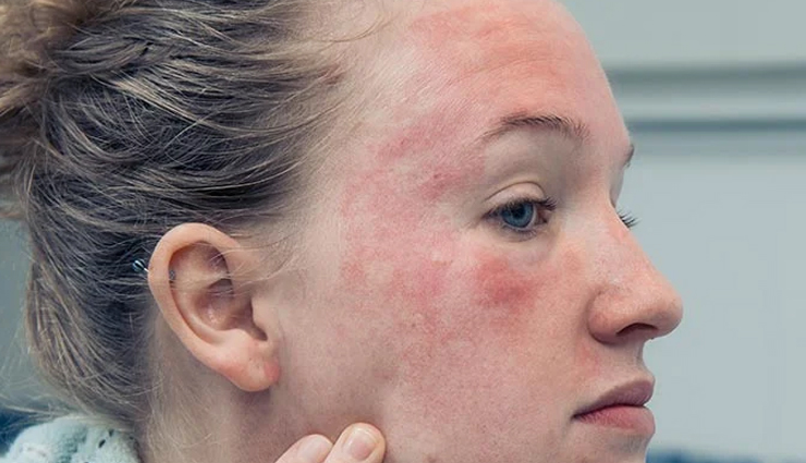 benefits of using vitamin e for skin,vitamin e for healthy skin,vitamin e skincare benefits,how vitamin e enhances skin,skin benefits of vitamin e,vitamin e and skin rejuvenation,vitamin e for skin health,vitamin e and skin care,antioxidant benefits of vitamin e for skin,vitamin e for youthful skin,vitamin e and skin repair,vitamin e and skin protection,nourishing skin with vitamin e,vitamin e for radiant skin,vitamin e for soft and smooth skin,moisturizing with vitamin e for skin,vitamin e and skin elasticity,reducing skin damage with vitamin e,skin regeneration with vitamin e,vitamin e and skin blemishes,vitamin e and skin texture improvement,natural remedies for healthy skin with vitamin e,vitamin e for skin hydration,vitamin e and skin suppleness,vitamin e for beautiful and glowing skin