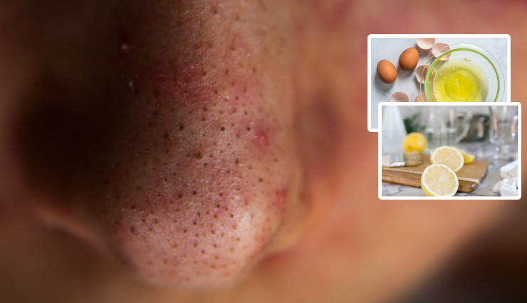 diy face masks,homemade face masks,natural face masks,2 ingredient face masks,glowing skin,healthy skin,skin care,beauty tips,skin problems,blackheads,oily skin,acne,aging,skin tightening,deep cleaning pores,clear skin,brighten skin,reduce dark spots,hydrate skin,exfoliate skin