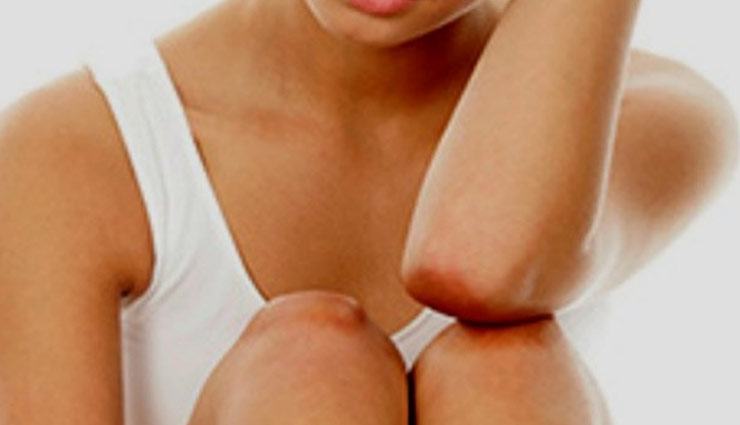 घुटने और कोहनी के कालेपन को दूर करे इन घरेलू तरीको की मदद से