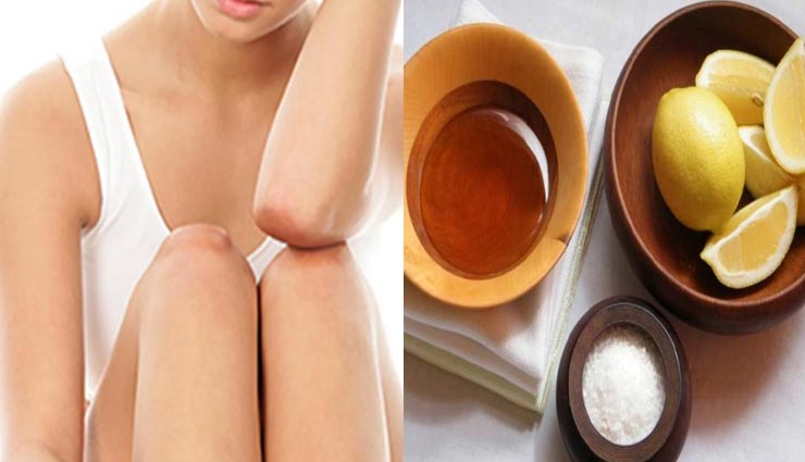 beauty tips,beauty tips in hindi,home remedies,tips to get rid of blackness of elbow,blackness of elbow remedies