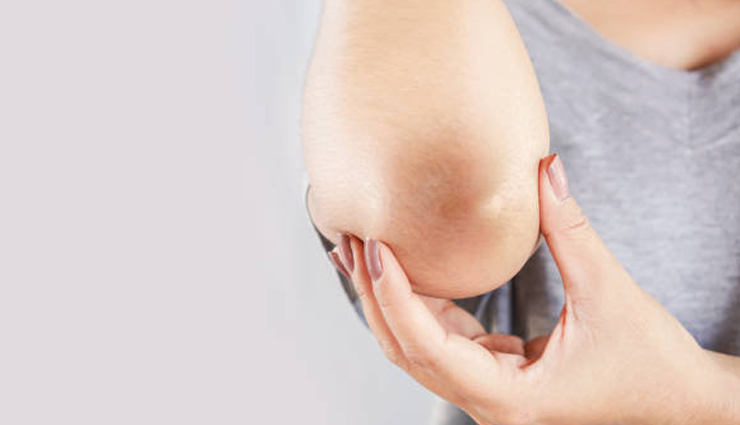 rough elbows treatment,home remedies for dry elbows,natural remedies for rough skin,how to soften rough elbows,dry elbow care tips,smooth elbows naturally,treat elbow dryness at home,skincare for rough elbows,elbow softening home remedies,remove dead skin from elbows