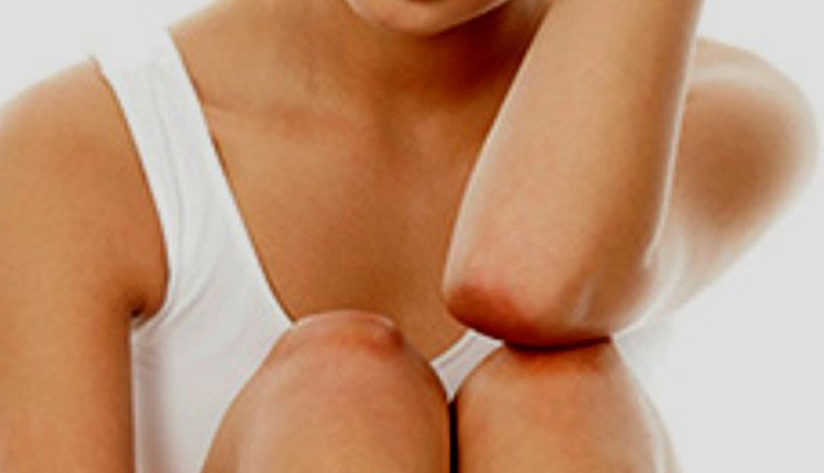 5 Remedies To Get Rid of Rough Dark Elbows