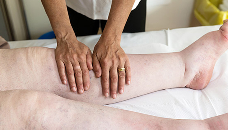 what is elephantiasis,elephantiasis treatment,lymphatic filariasis,elephantiasis symptoms,causes of elephantiasis,how to treat elephantiasis,elephantiasis diagnosis,elephantiasis medications,antiparasitic drugs for elephantiasis,managing elephantiasis symptoms,elephantiasis prevention,elephantiasis mosquito control,diethylcarbamazine for elephantiasis,ivermectin treatment elephantiasis,albendazole for elephantiasis,lymphedema management in elephantiasis,hygiene for elephantiasis,surgical interventions for elephantiasis,elephantiasis skin care,secondary infections in elephantiasis,elephantiasis public health impact,who elephantiasis initiatives,elephantiasis in tropical regions,elephantiasis support groups,education on elephantiasis,elephantiasis global burden,symptoms of lymphatic filariasis,treating lymphatic filariasis,microfilariae detection,prevention of lymphatic filariasis