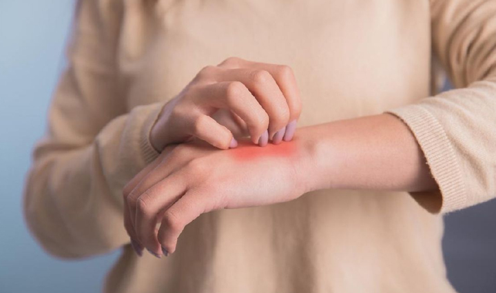 खुजली की समस्या उठते ही बंद कर दें ये आहार, बढ़ सकती हैं परेशानी 