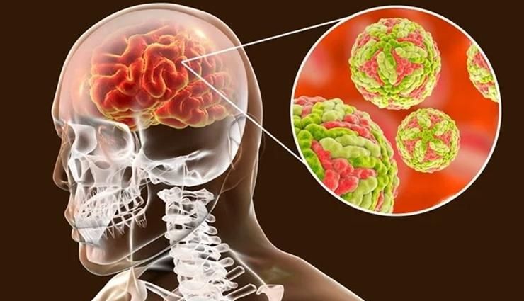 कई खतरनाक बीमारियों का कारण बनते हैं मच्छर, शुरू कर दीजिए सावधानी बरतना mosquito-borne diseases and precautions,protecting against mosquito-borne illnesses,dangers of mosquitoes and disease prevention,mosquito-borne infections and preventive measures,preventing diseases transmitted by mosquitoes,mosquito-borne illness prevention tips,importance of mosquito precautions for health,mosquito-borne diseases and proactive measures,safeguarding against mosquito-borne viruses,taking precautions against mosquito-related diseases