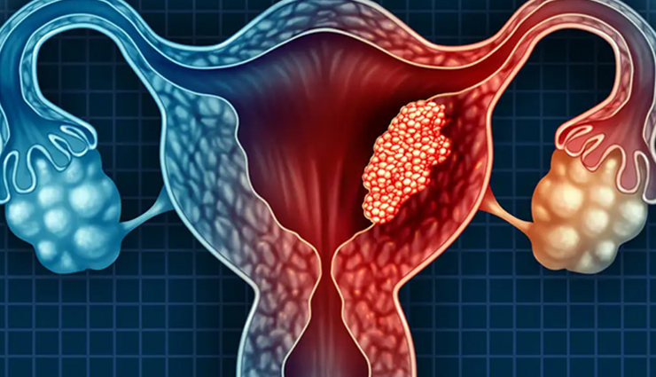 irregular periods,causes of irregular periods,hormonal imbalances,stress and periods,weight changes and menstruation,medications causing irregular periods,medical conditions affecting periods,irregular menstrual cycle