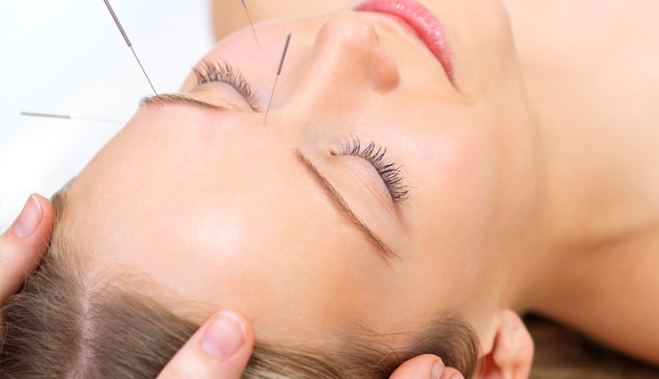 epilepsy,epilepsy treatment,home remedies to treat epilepsy,epilepsy problem,best remedies for epilepsy,Health,Health tips