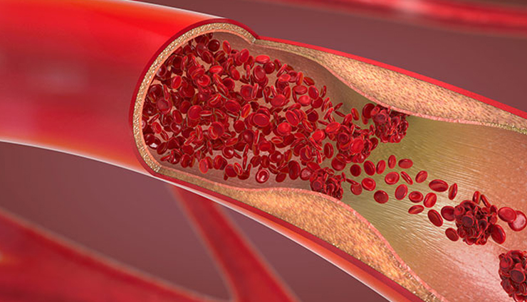 epsom salt,health benefits of epsom salt,Health tips,fitness tips