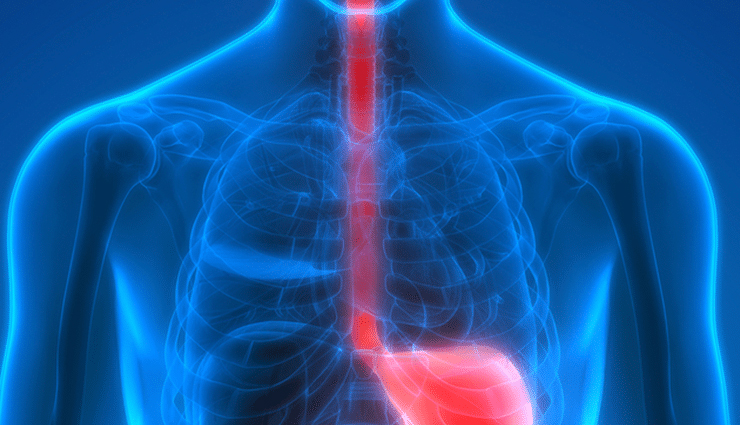 apple cider vinegar side effects,side effects of drinking too much apple cider vinegar,acv side effects on health,negative effects of excessive apple cider vinegar consumption,risks of drinking too much apple cider vinegar,apple cider vinegar drawbacks and side effects,health complications from excessive acv consumption,adverse effects of consuming large amounts of apple cider vinegar