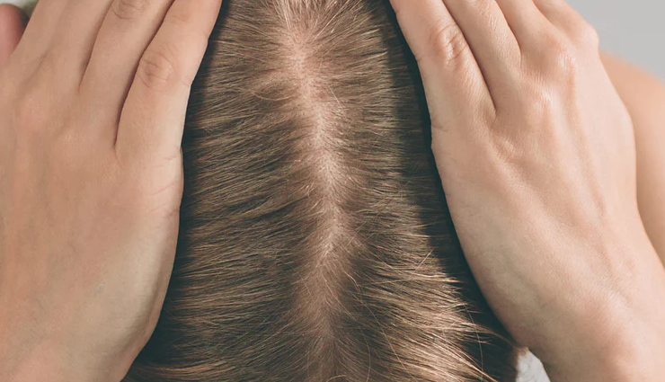 coffee for hair growth,benefits of coffee on hair,hair growth with coffee,coffee scalp treatment benefits,coffee hair care benefits,using coffee for healthy hair,coffee impact on hair growth,natural hair growth remedies,coffee hair treatment advantages,coffee for strong hair growth,caffeine for hair growth,coffee-infused hair care,stimulating hair with coffee,coffee scalp stimulation,coffee extract for hair,coffee-based hair treatments,hair benefits of caffeine,caffeine hair care solutions,coffee effect on hair health,coffee rinse for hair growth