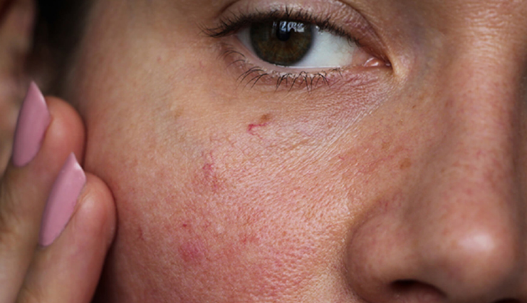 pear skincare benefits,natural pear beauty remedies,anti-aging benefits of pear,hair care with pear,pear for glowing skin,benefits of pear for skin health,nutrients in pear for beauty,homemade pear beauty recipes,benefits of pear for hair growth,pear-based beauty products,pears for skincare,benefits of pears for skin,pears for healthy skin,pears for glowing skin,pears for clear skin,pears for anti-aging,natural skincare with pears,pears for acne-prone skin,pears for skin hydration,pears for sensitive skin