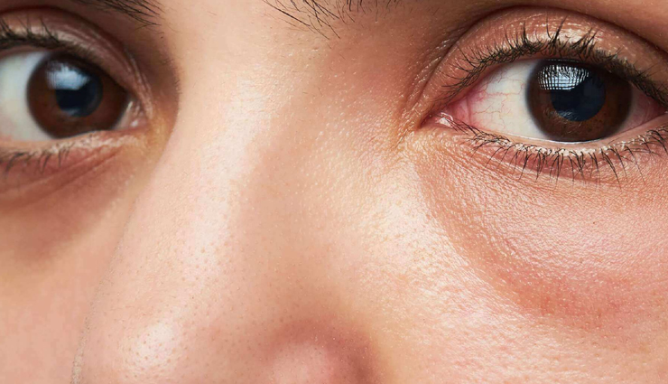 stress and beauty,impact of stress on physical appearance,surprising effects of stress on beauty,beauty problems caused by stress,mental health and beauty,stress and skin problems,hair loss due to stress,dark circles caused by stress,stress and acne,how stress affects your appearance