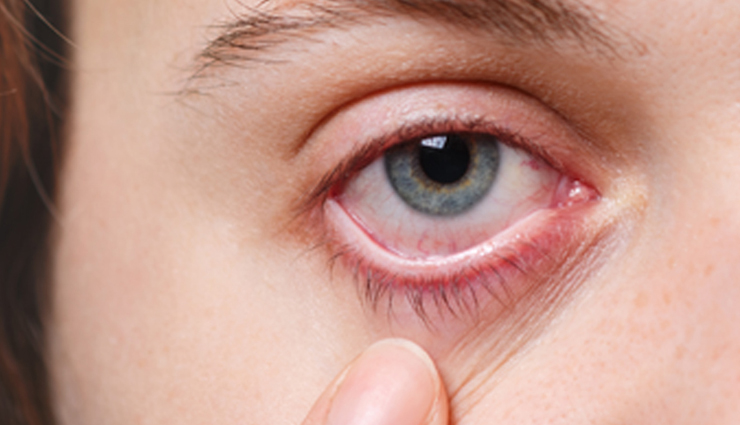 diabetes complications,diabetes side effects,diabetes health risks,diabetes and heart disease,diabetic neuropathy,diabetic retinopathy,diabetes and kidney disease,diabetes and skin problems,diabetes and dental problems,diabetes and erectile dysfunction,diabetes and infection risk,diabetes and depression,managing diabetes complications,preventing diabetes complications,diabetes health tips,type 1 diabetes complications,type 2 diabetes complications,gestational diabetes complications,long-term diabetes complications,acute diabetes complications,diabetes side effects on eyes,diabetes side effects on nerves,diabetes side effects on kidneys,diabetes side effects on heart,diabetes complications management strategies,diabetes complications prevention tips,diabetic foot problems,diabetes and oral health,diabetes and weight management,diabetes lifestyle management