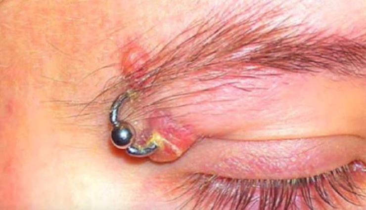 eyebrows,pimples on eyebrows,causes of pimples on eyebrows,major causes of pimples on eyebrows,5 major causes of pimples on eyebrows,beauty,beauty news in hindi