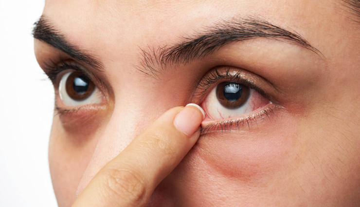 pineapple,pineapple healthy food,pineapple benefits,eating pineapple benefits,healthy food,healthy life,Health,Health tips