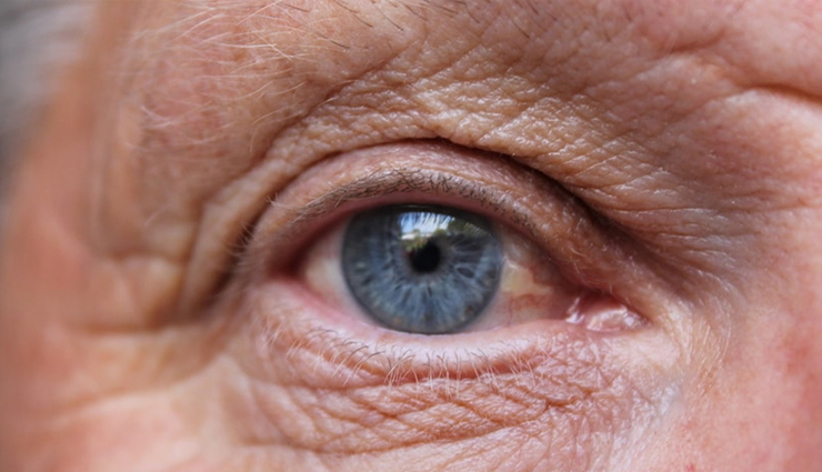 figs,health benefits of figs,figs for good health,healthy food figs,figs for good health,healthy food figs for body,body care,healthy food,healthy living,Health tips