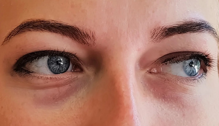 baby powder beauty tips,baby powder for skin,baby powder for hair,beauty hacks with baby powder,oil control with baby powder,dandruff remedy baby powder,natural beauty tips,skincare with baby powder,baby powder uses,beauty secrets