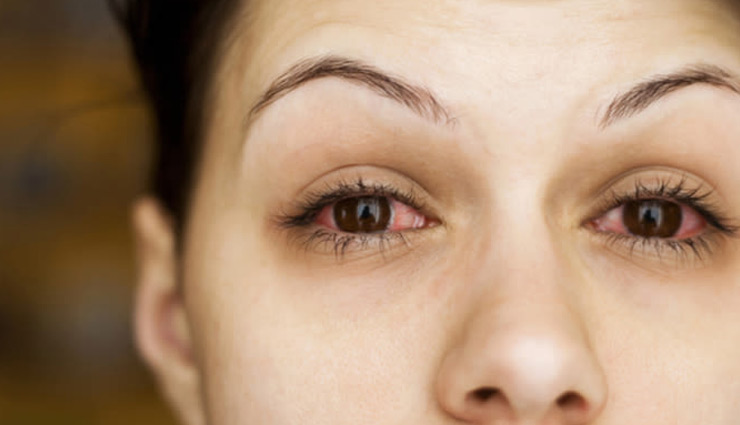 micron eye symptoms,corona symptoms in eye,corona treatment,corona medicine,who medicine guideline,corona virus,omicron corona variant