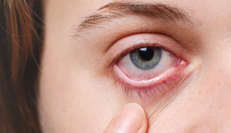 फैटी लीवर की समस्या से जूझ रहे थे सिंगर KK, जानें इस बीमारी के बारे मे सबकुछ fatty liver,fatty liver symptoms,fatty liver causes,fatty liver treatment,healthy living,Health tips,Health