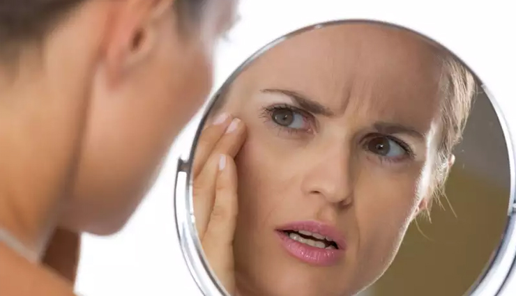 7 Signs on Your Face That Tell About Diseases
