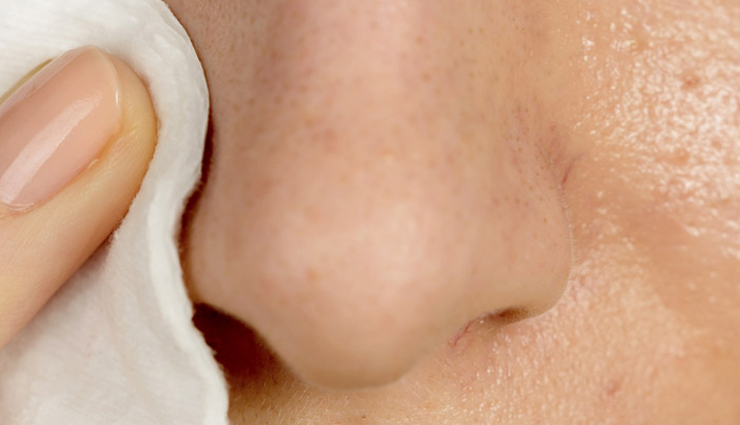 hydrogen peroxide blackhead removal,removing blackheads with hydrogen peroxide,hydrogen peroxide for blackhead treatment,how to remove blackheads using hydrogen peroxide,hydrogen peroxide skincare for blackheads,diy blackhead removal with hydrogen peroxide,hydrogen peroxide remedy for blackheads,tips for using hydrogen peroxide to remove blackheads,effective blackhead removal using hydrogen peroxide,hydrogen peroxide solution for clear skin and blackhead removal