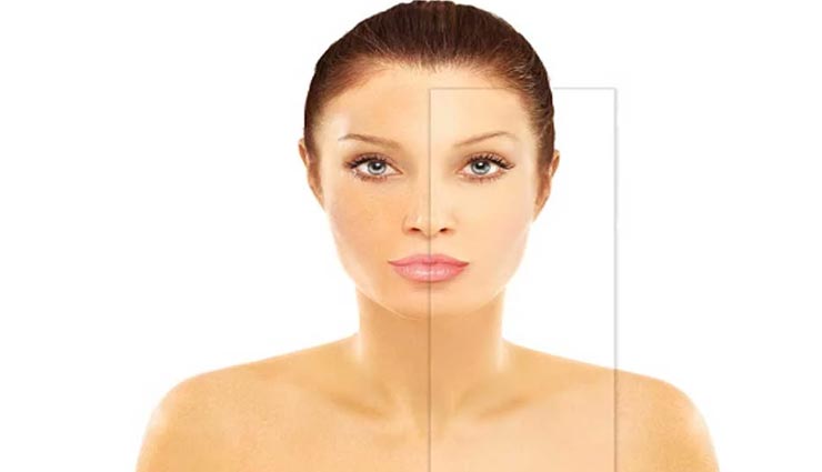 त्वचा से जुड़े ये नुस्खें कहीं बन ना जाए आपकी परेशानी