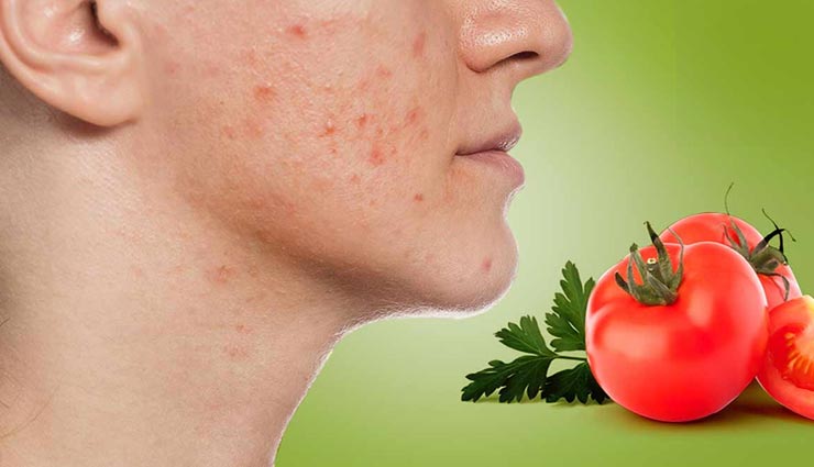 आपकी त्वचा को जवां बनाएंगे टमाटर से बने ये 5 बेहतरीन फेसपैक