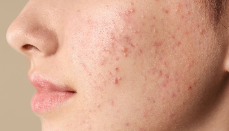 diy face mask for skin problems,homemade face mask for different skin issues,natural face mask recipes for skincare,diy facial mask for various skin concerns,homemade facial masks for skincare,diy masks for clear skin,natural remedies for skin issues,facial masks for radiant skin,diy skincare mask recipes,homemade masks for healthy skin,face mask remedies for skin concerns,diy solutions for skincare problems,homemade facial treatments for skin issues,natural face masks for various skin conditions