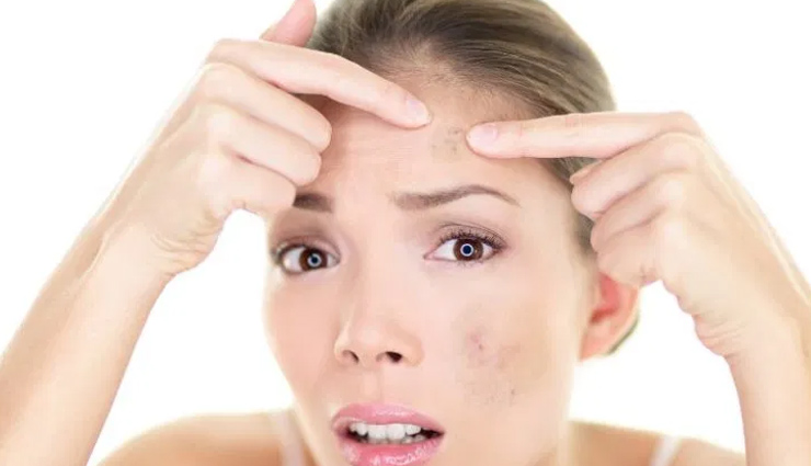 homemade face packs,face packs to get rid of dark spots,tips for dark spots,skin care tips,beauty tips