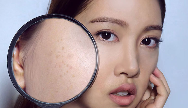 5 Homemade Face Packs To Help You Get Rid of Dark Spots