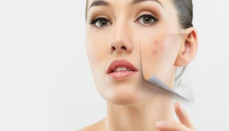 homemade face packs,face packs to get rid of dark spots,tips for dark spots,skin care tips,beauty tips