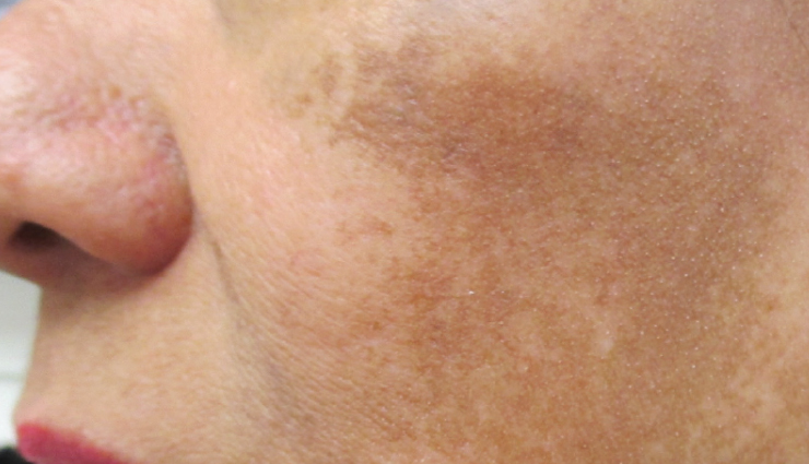 effects of cosmetics on skin,cosmetic ingredients to avoid for skin,harmful effects of cosmetics on skin,safe cosmetics for sensitive skin,how cosmetics affect skin health,cosmetic allergy symptoms,skin reactions to cosmetics,best cosmetics for healthy skin,organic cosmetics benefits for skin,cosmetic safety tips for skin,त्वचा के लिए टिप्स (tvacha ke liye tips),त्वचा के नुस्खे (tvacha ke nuskhe),स्किन केयर टिप्स हिंदी में (skin care tips hindi mein),प्राकृतिक स्किन केयर टिप्स (prakritik skin care tips),ग्लोइंग स्किन के लिए टिप्स (glowing skin ke liye tips),होममेड स्किन केयर टिप्स (homemade skin care tips),स्किन केयर के उपाय (skin care ke upay),स्किन केयर निखराव (skin care nikhraav),स्किन केयर सलाह (skin care salah),स्किन केयर रूटीन (skin care routine)