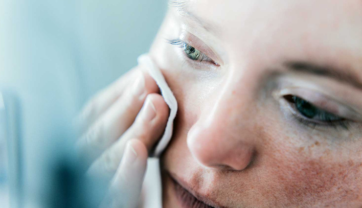 home remedies,home remedies for face redness,face care tips,summer sin care tips,skin care tips,beauty tips