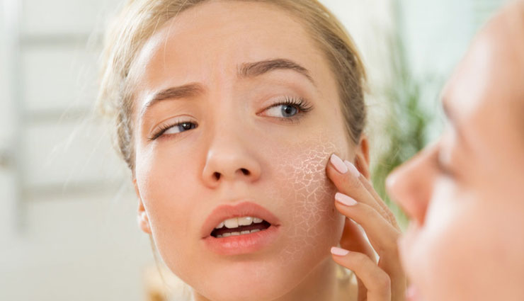 5 Homemade Face Packs To Treat Dry Skin
