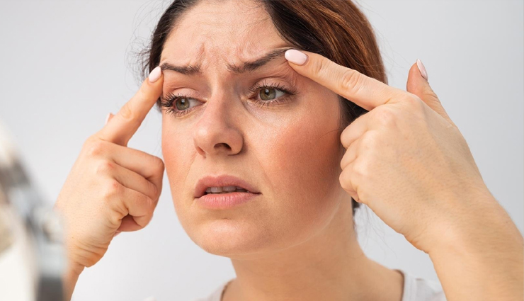 forehead wrinkles diy remedies,natural ways to reduce forehead wrinkles,diy methods for smoother forehead skin,get rid of frown lines naturally,homemade remedies for forehead wrinkles,diy treatments for smoother forehead,natural remedies for forehead wrinkles,effective diy solutions for frown lines,reduce forehead wrinkles at home,diy tips for younger-looking forehead skin