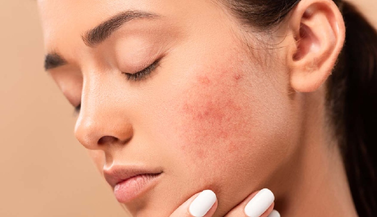 cocoa butter benefits,beauty tips,natural skincare,dark spots remedy,chapped lips treatment,glowing skin,dry skin moisturizer,cocoa butter for hair,uv protection,uneven skin tone remedy