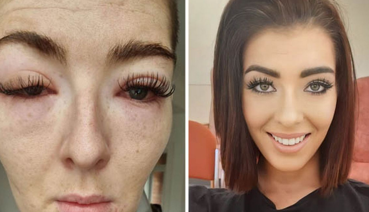 नकली पलकें लगाने के बाद महिला के साथ हुआ कुछ ऐसा जिसने दिया नर्क जैसा अहसास 