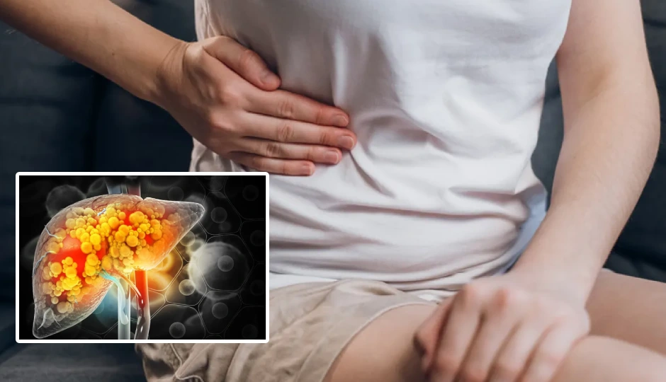 महिलाओं में फैटी लिवर का बढ़ता खतरा, इन संकेतों को न करें इग्नोर