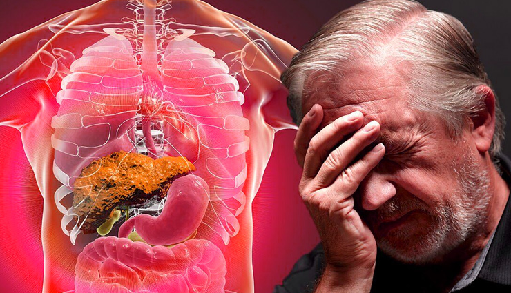 क्या शराब ने पूरी तरह से खराब कर दिया है आपका लिवर, इन 4 लक्षणों से पहचानें