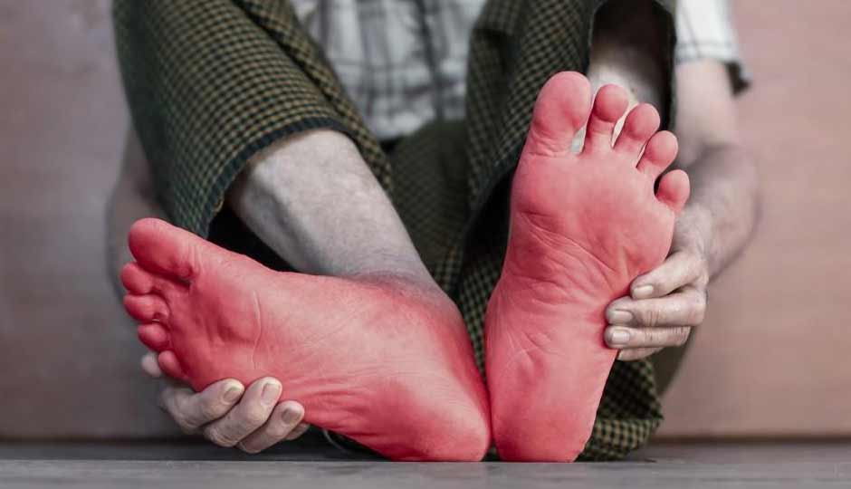 5 Reasons Why Your Feet Go Numb Quickly