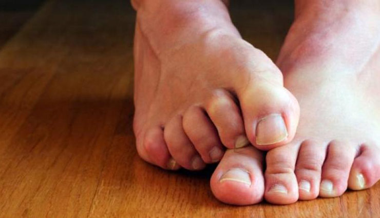 बिमारियों का संकेत देते हैं पैरों में आए ये बदलाव, नजरअंदाज करना खतरनाक